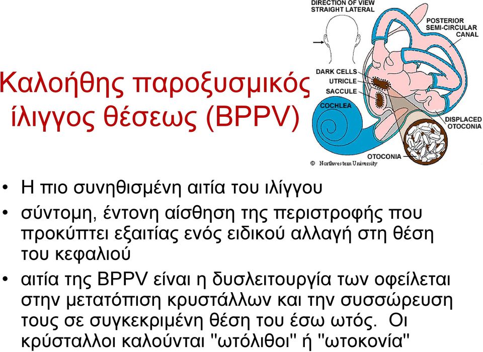 κεφαλιού αιτία της BPPV είναι η δυσλειτουργία των οφείλεται στην µετατόπιση κρυστάλλων και