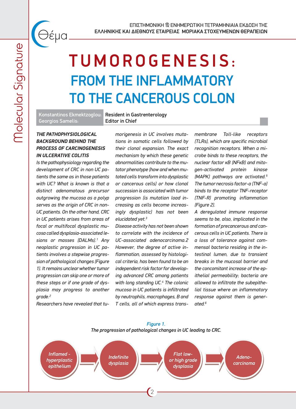 with UC? What is known is that a distinct adenomatous precursor outgrowing the mucosa as a polyp serves as the origin of CRC in non- UC patients.