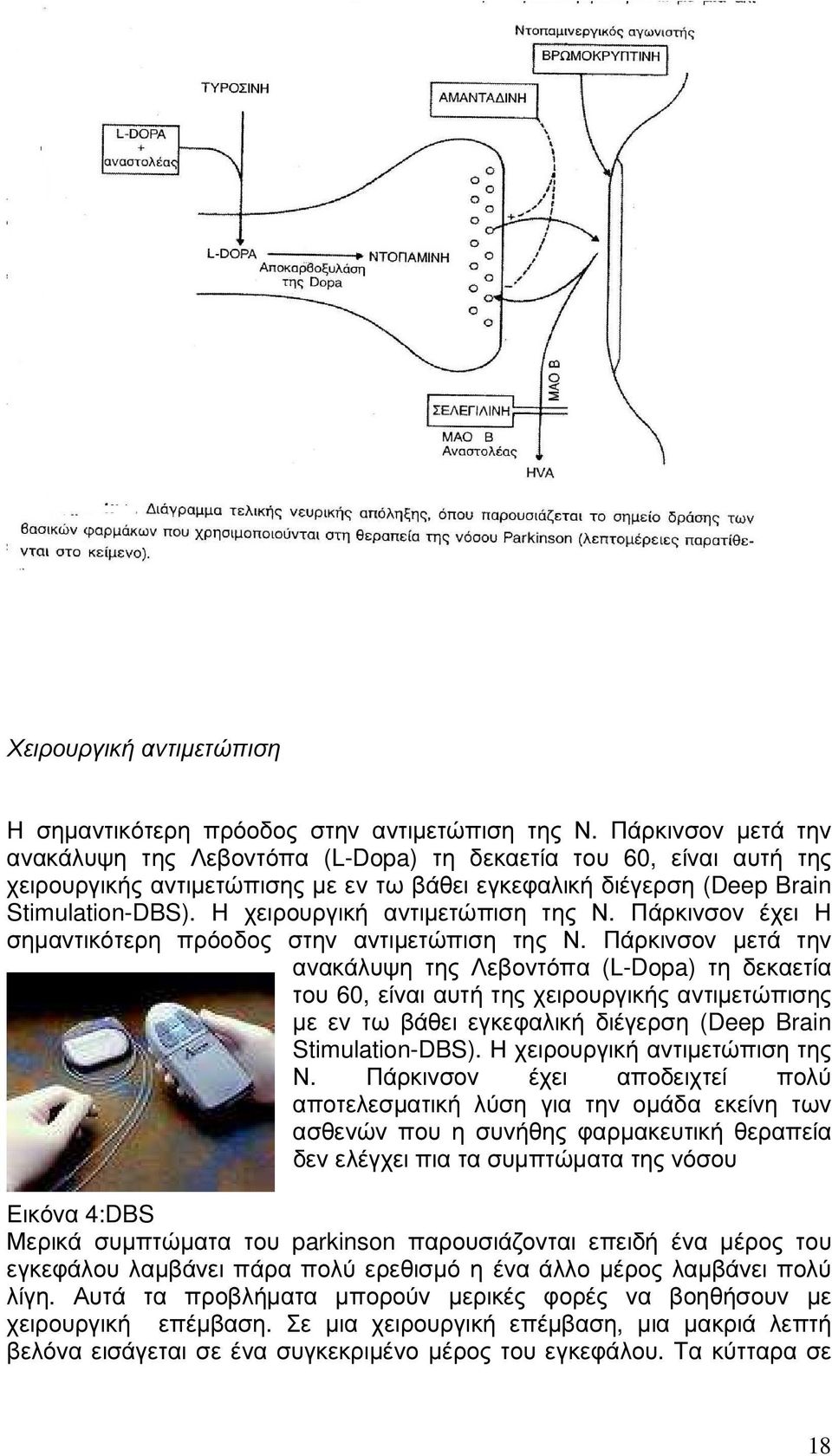 Η χειρουργική αντιµετώπιση της Ν. Πάρκινσον έχει Η σηµαντικότερη πρόοδος στην αντιµετώπιση της Ν.  Η χειρουργική αντιµετώπιση της Ν.