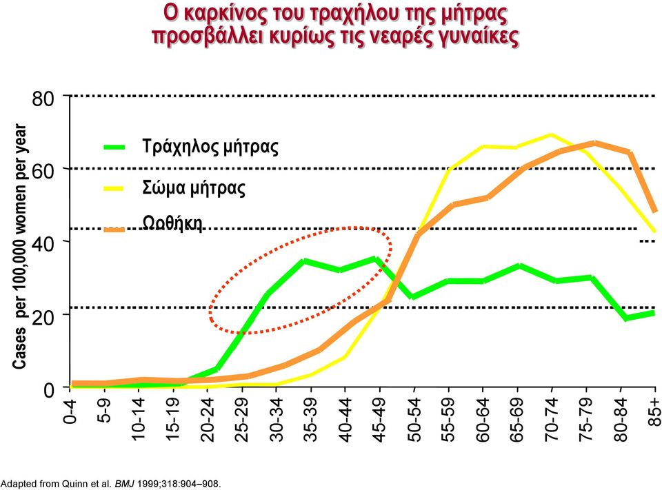 ηξαρήινπ ηεο κήηξαο πξνζβάιιεη θπξίσο ηηο λεαξέο γπλαίθεο 80 60 40 Σξάρεινο