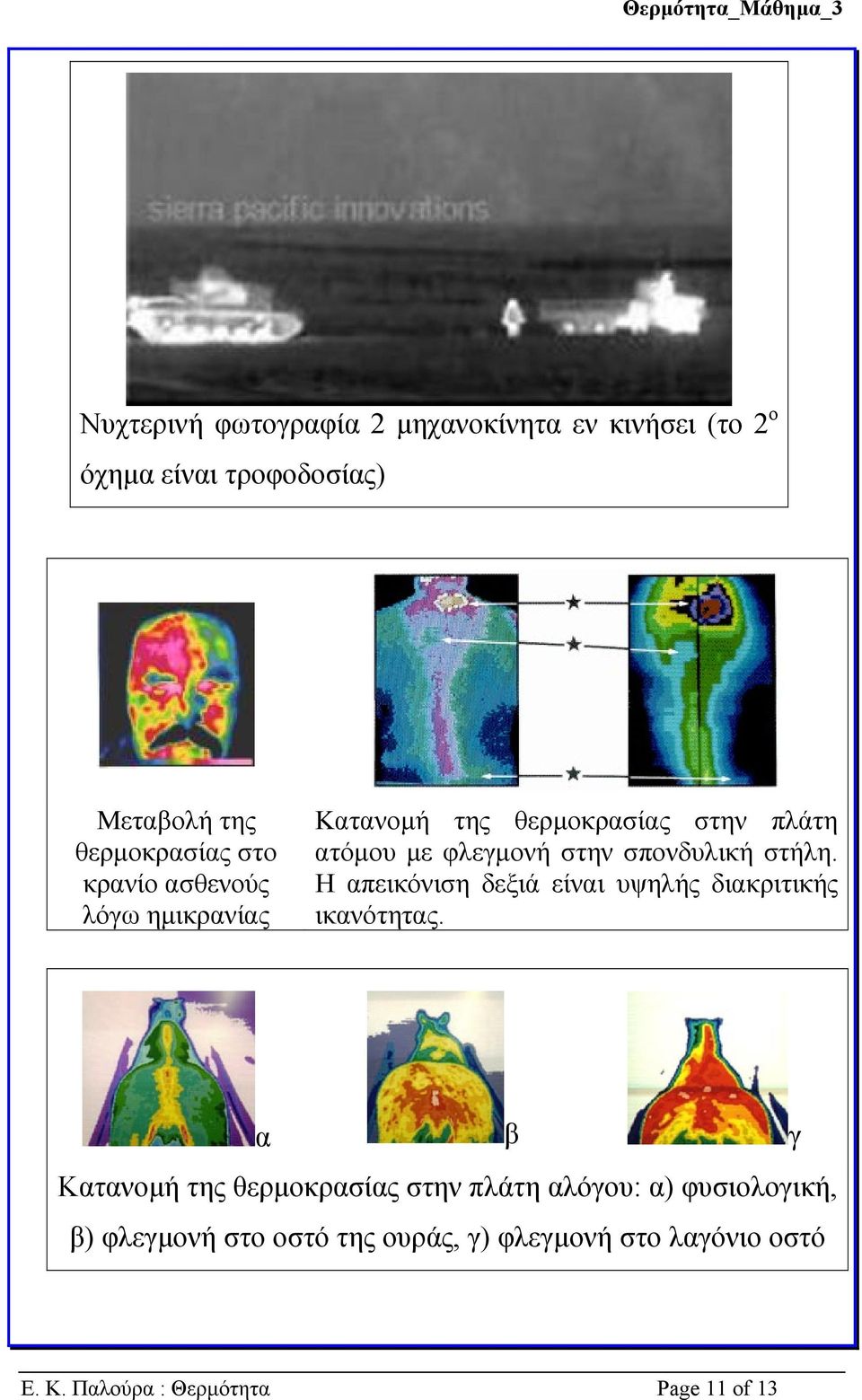 Η απεικόνιση δεξιά είναι υψηλής διακριτικής ικανότητας.