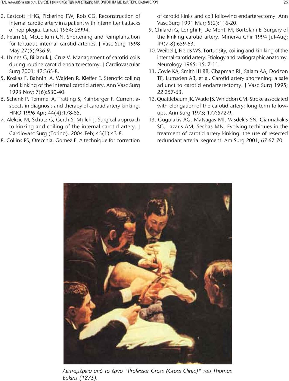 Shortening and reimplantation for tortuous internal carotid arteries. J Vasc Surg 1998 May 27(5):936-9. 4. Lhines G, Bilianuk J, Cruz V.