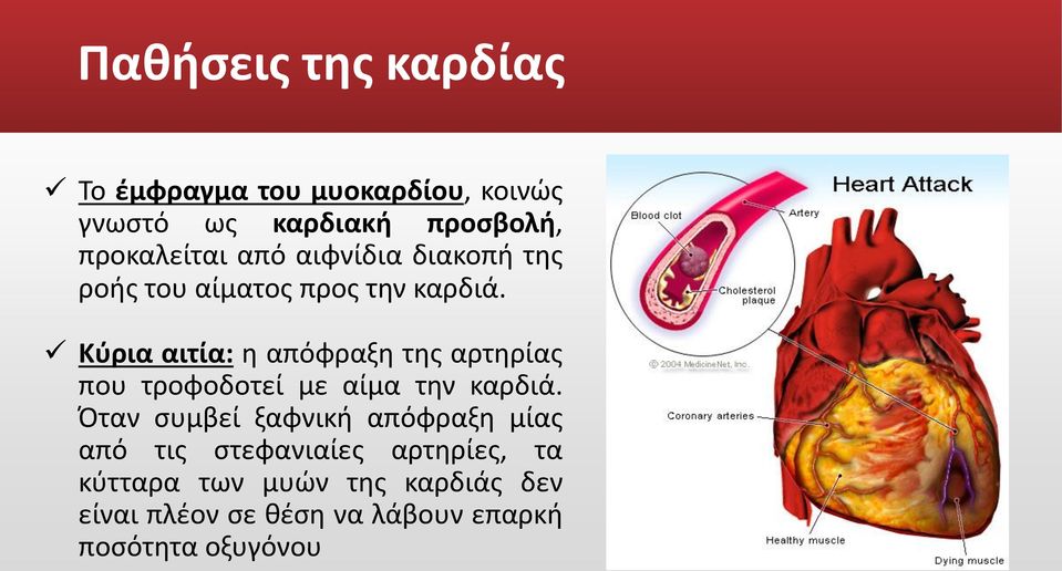 Κύρια αιτία: η απόφραξη της αρτηρίας που τροφοδοτεί με αίμα την καρδιά.