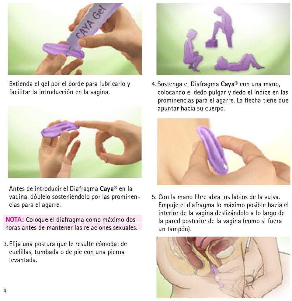 Antes de introducir el Diafragma Caya en la vagina, dóblelo sosteniéndolo por las prominencias para el agarre.