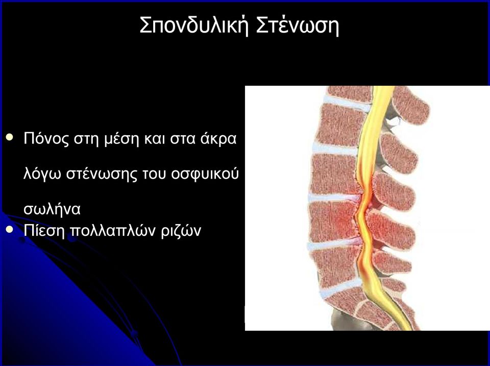 λόγω στένωσης του