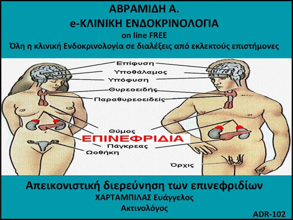 ΕΠΙΝΕΥΡΙΔΙΩΝ