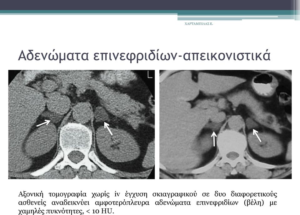 δηαθνξεηηθνχο αζζελείο αλαδεηθλχεη ακθνηεξφπιεπξα