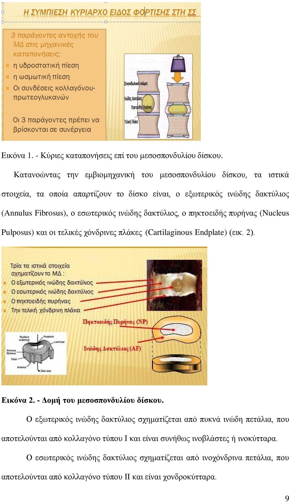 εσωτερικός ινώδης δακτύλιος, ο πηκτοειδής πυρήνας (Nucleus Pulposus) και οι τελικές χόνδρινες πλάκες (Cartilaginous Endplate) (εικ. 2). Εικόνα 2.