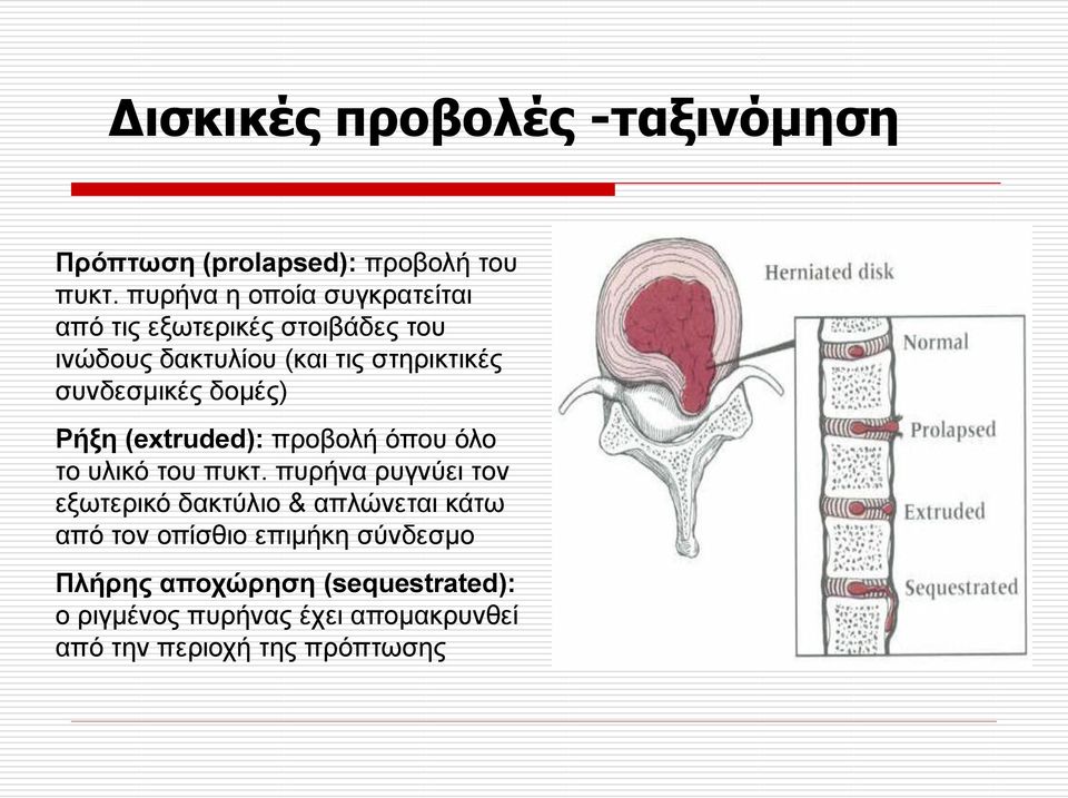 ζπλδεζκηθέο δνκέο) Ρήμε (extruded): πξνβνιή όπνπ όιν ην πιηθό ηνπ ππθη.