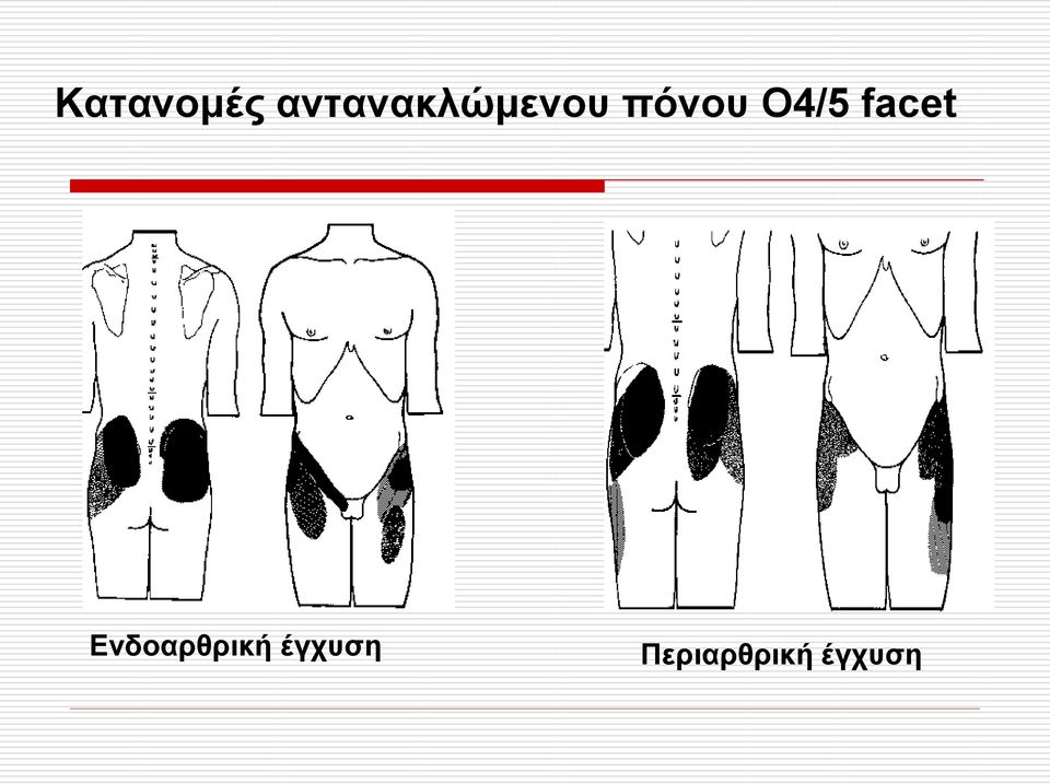 πόλνπ Ο4/5 facet