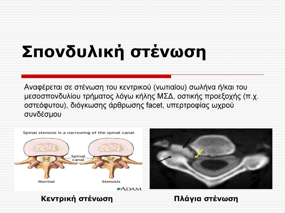 θήιεο ΜΓ, νζηηθήο πξνεμνρή