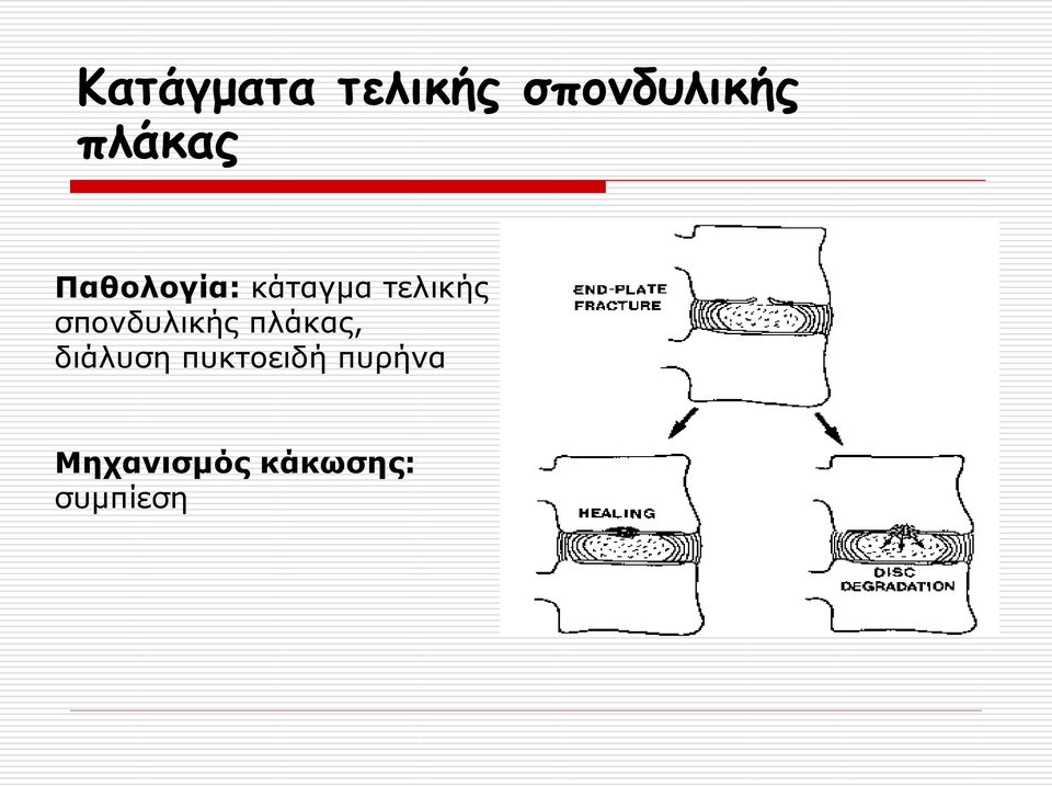 ζπνλδπιηθήο πιάθαο, δηάιπζε