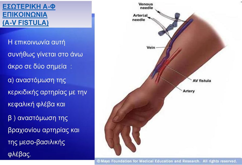 ηεο θεξθηδηθήο αξηεξίαο κε ηελ θεθαιηθή θιέβα θαη β )