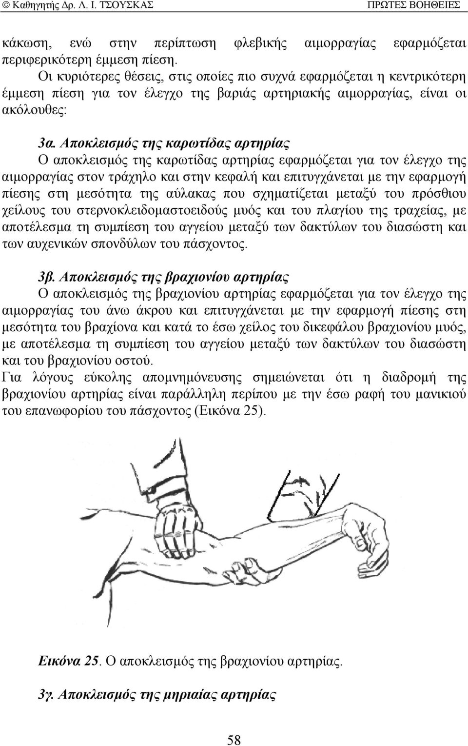 Αποκλεισµός της καρωτίδας αρτηρίας Ο αποκλεισµός της καρωτίδας αρτηρίας εφαρµόζεται για τον έλεγχο της αιµορραγίας στον τράχηλο και στην κεφαλή και επιτυγχάνεται µε την εφαρµογή πίεσης στη µεσότητα