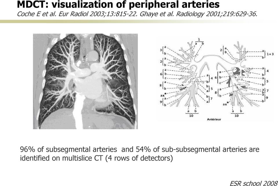 Radiology 2001;219:629-36.