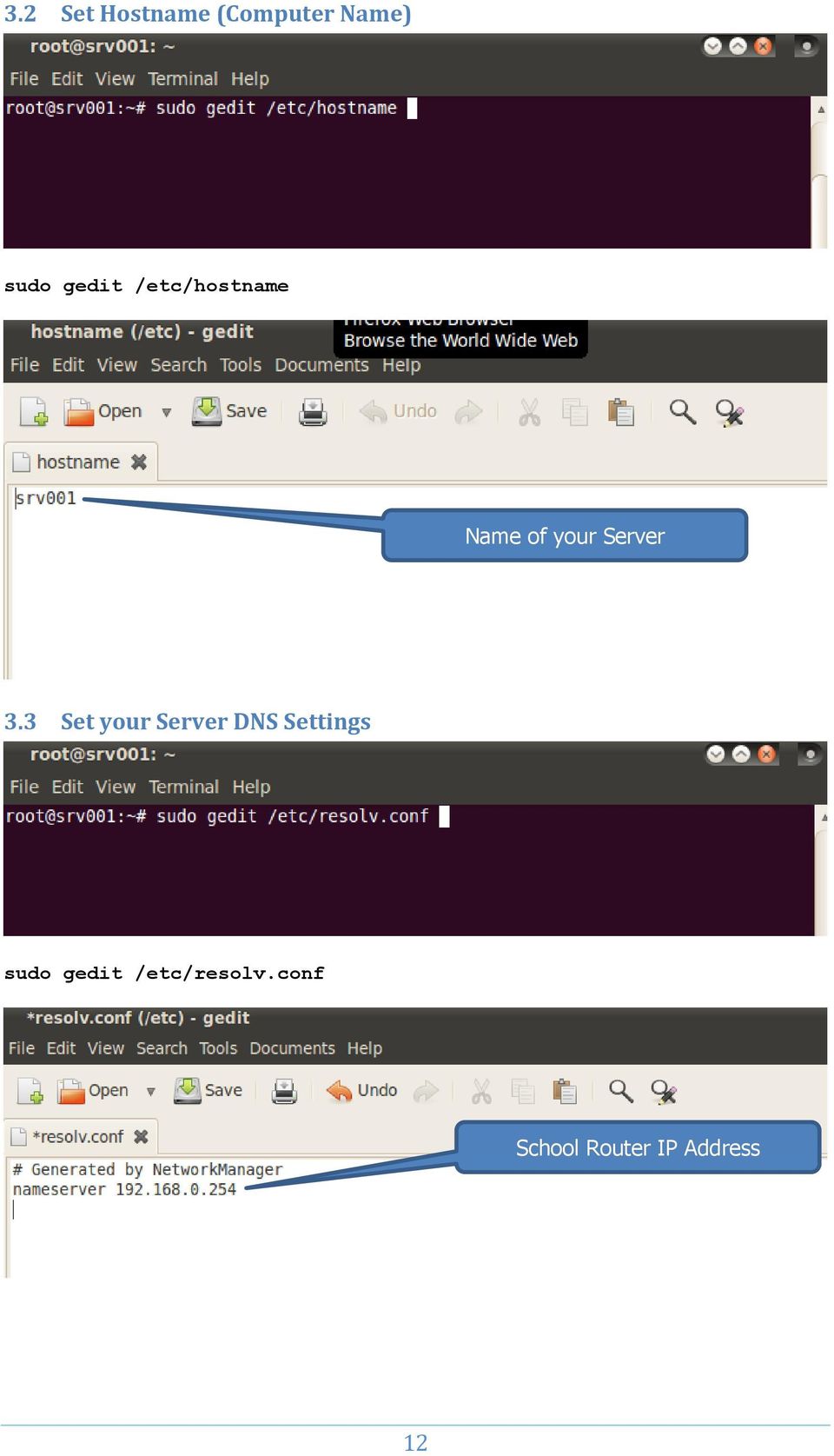 3 Set your Server DNS Settings sudo gedit