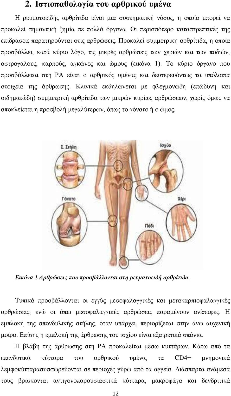 Προκαλεί συμμετρική αρθρίτιδα, η οποία προσβάλλει, κατά κύριο λόγο, τις μικρές αρθρώσεις των χεριών και των ποδιών, αστραγάλους, καρπούς, αγκώνες και ώμους (εικόνα 1).