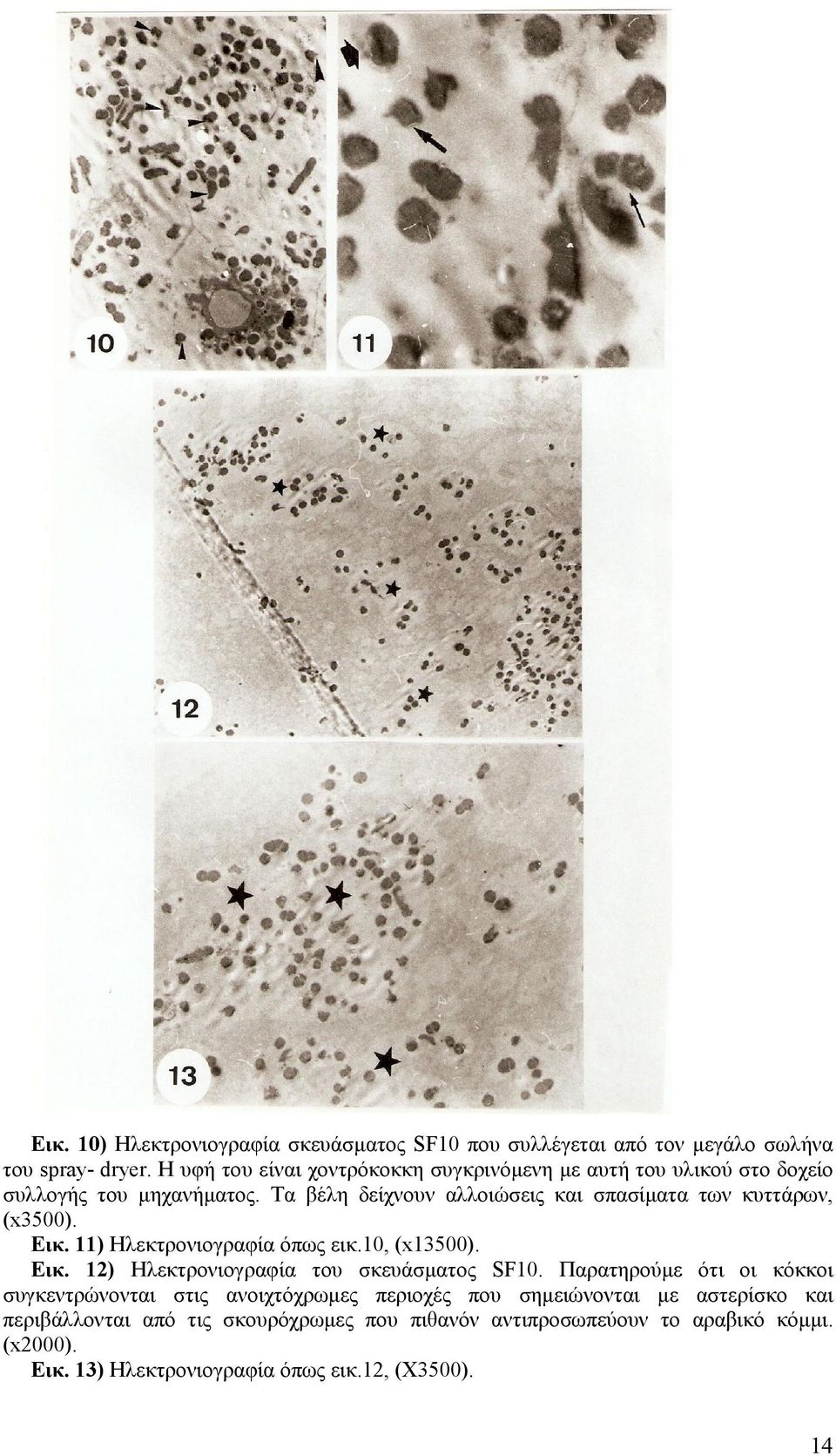 Τα βέλη δείχνουν αλλoιώσεις και σπασίµατα των κυττάρων, (x3500). Εικ. 11) Ηλεκτρονιογραφία όπως εικ.10, (x13500). Εικ. 12) Ηλεκτρονιογραφία του σκευάσµατος SF10.