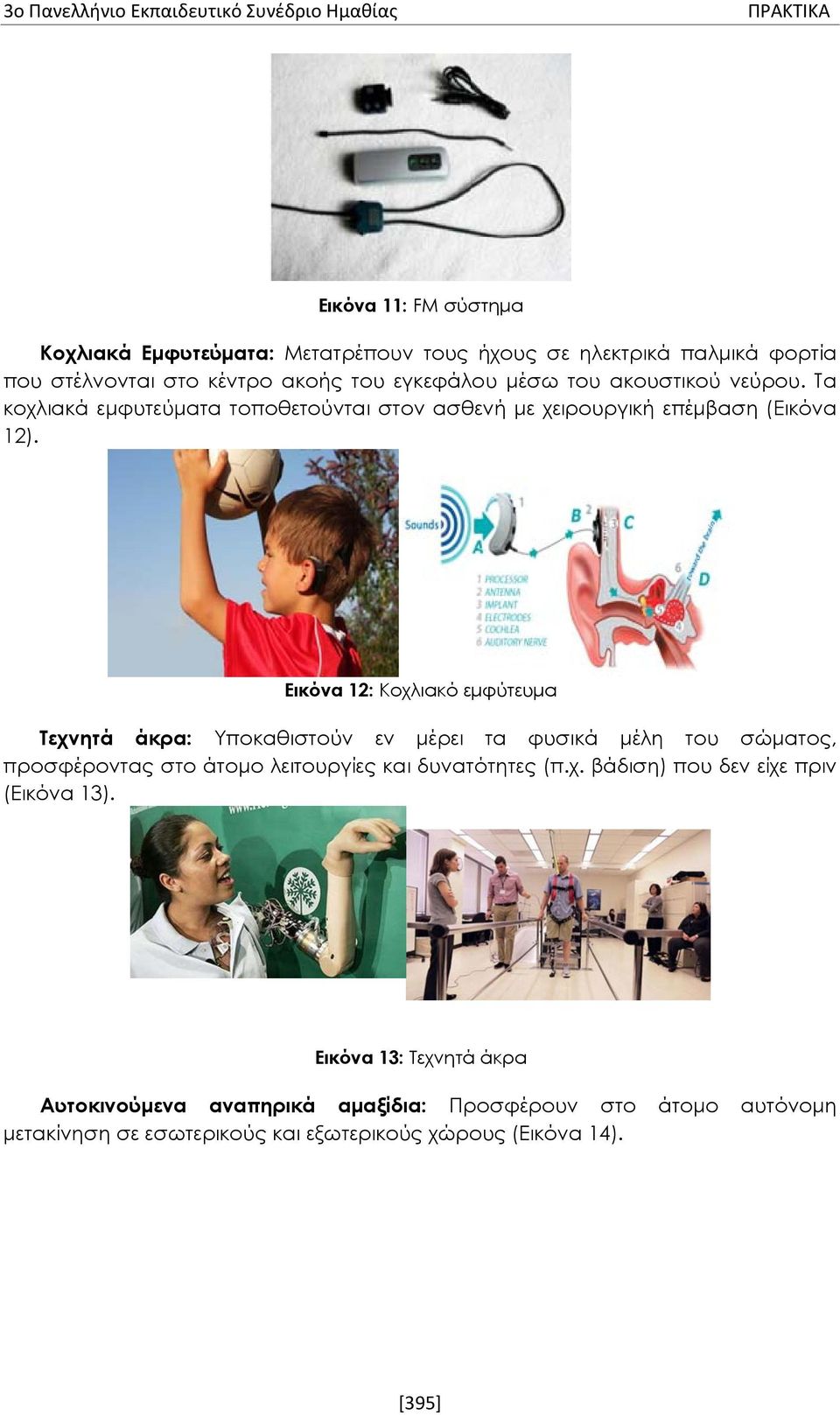 Εικόνα 12: Κοχλιακό εμφύτευμα Τεχνητά άκρα: Υποκαθιστούν εν μέρει τα φυσικά μέλη του σώματος, προσφέροντας στο άτομο λειτουργίες και δυνατότητες (π.χ. βάδιση) που δεν είχε πριν (Εικόνα 13).