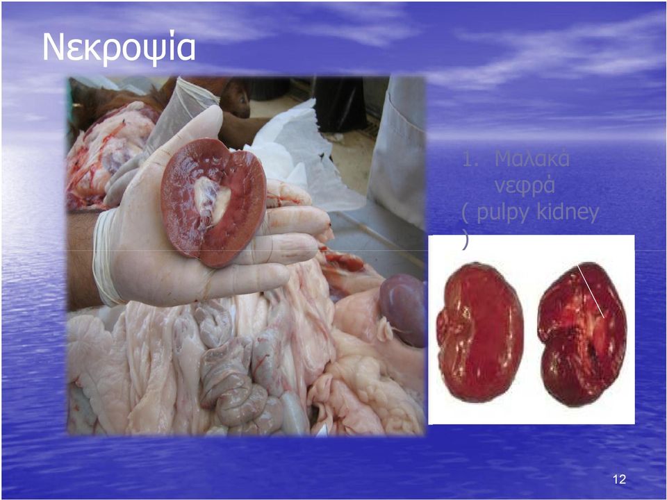 νεφρά (