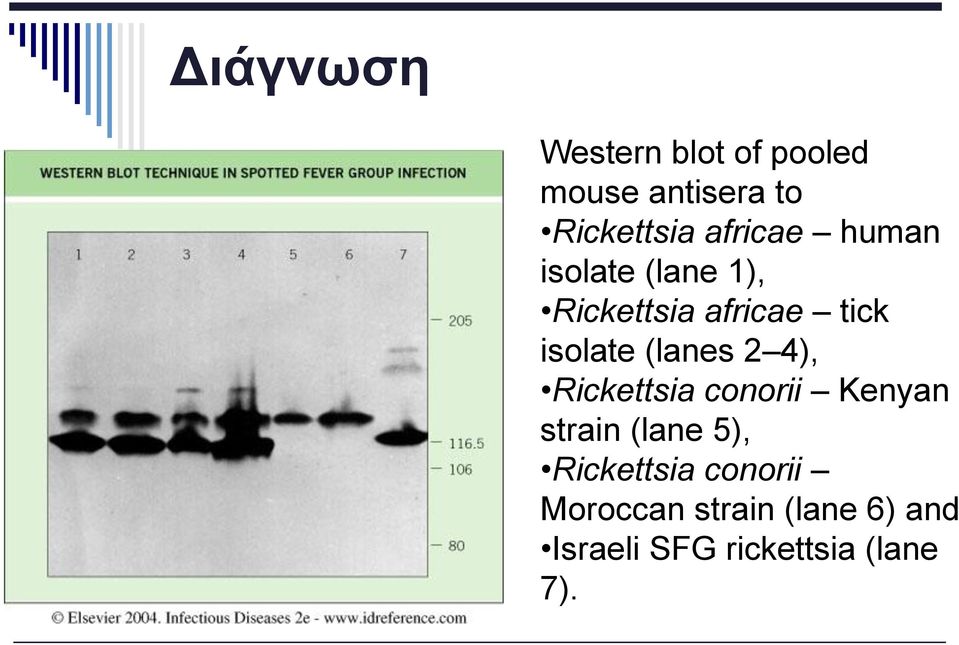 (lanes 2 4), Rickettsia conorii Kenyan strain (lane 5),