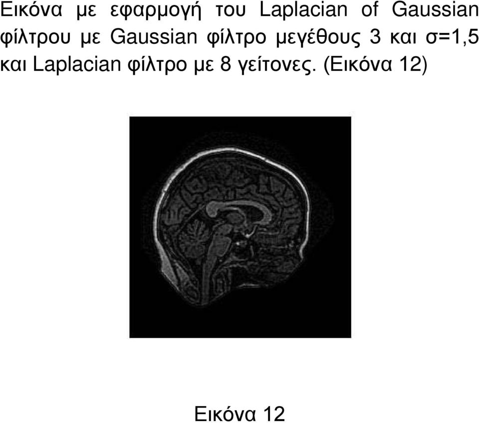 μεγέθους 3 και σ=1,5 και Laplacian