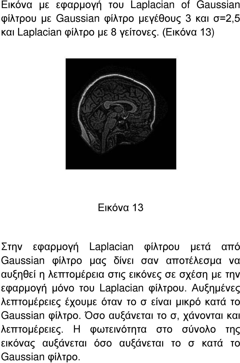 εικόνες σε σχέση με την εφαρμογή μόνο του Laplacian φίλτρου.