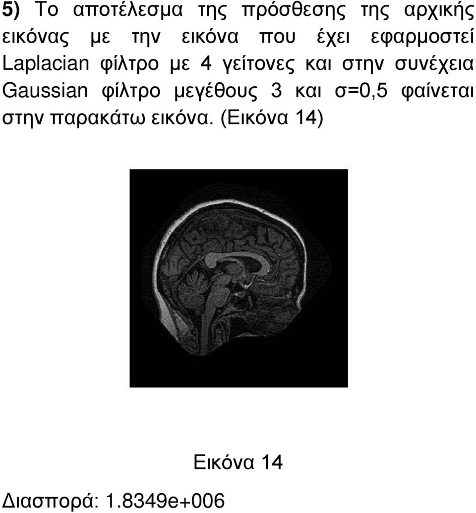 στην συνέχεια Gaussian φίλτρο μεγέθους 3 και σ=0,5 φαίνεται