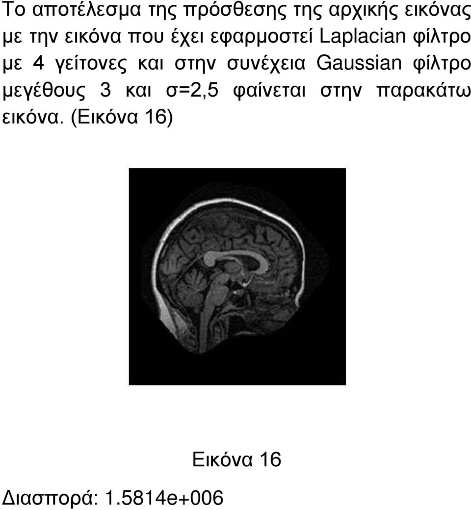 και στην συνέχεια Gaussian φίλτρο μεγέθους 3 και σ=2,5