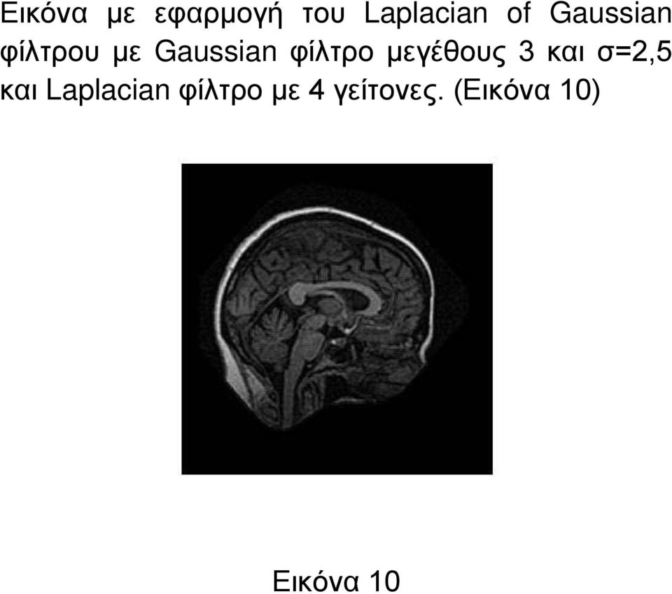 μεγέθους 3 και σ=2,5 και Laplacian