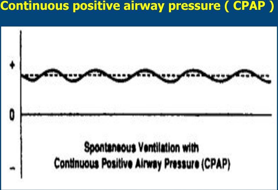 airway