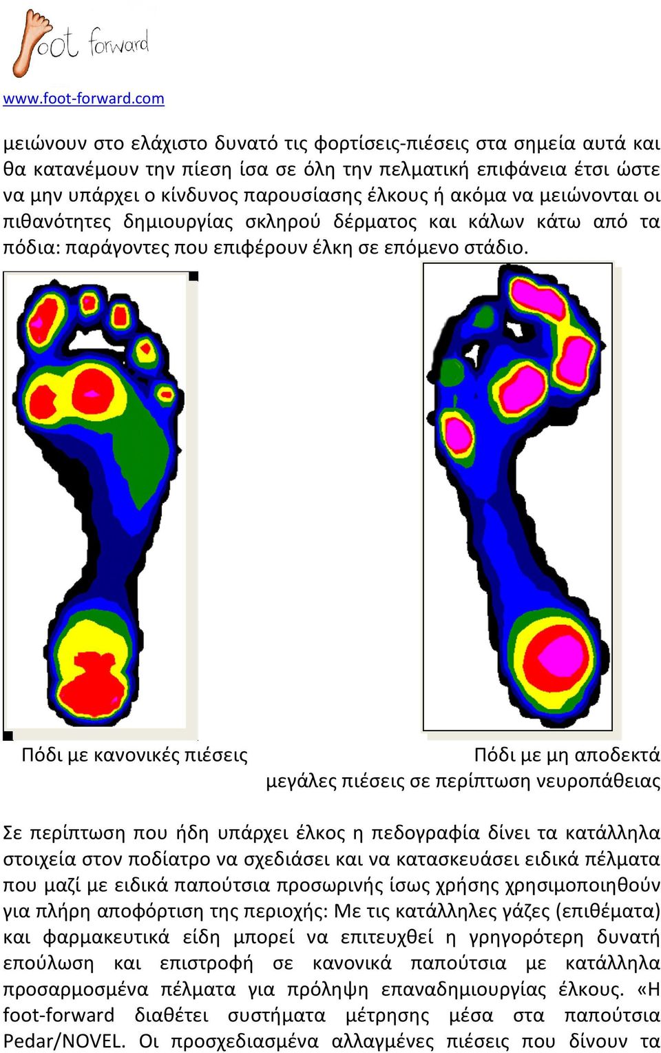 Πόδι με κανονικές πιέσεις Πόδι με μη αποδεκτά μεγάλες πιέσεις σε περίπτωση νευροπάθειας Σε περίπτωση που ήδη υπάρχει έλκος η πεδογραφία δίνει τα κατάλληλα στοιχεία στον ποδίατρο να σχεδιάσει και να