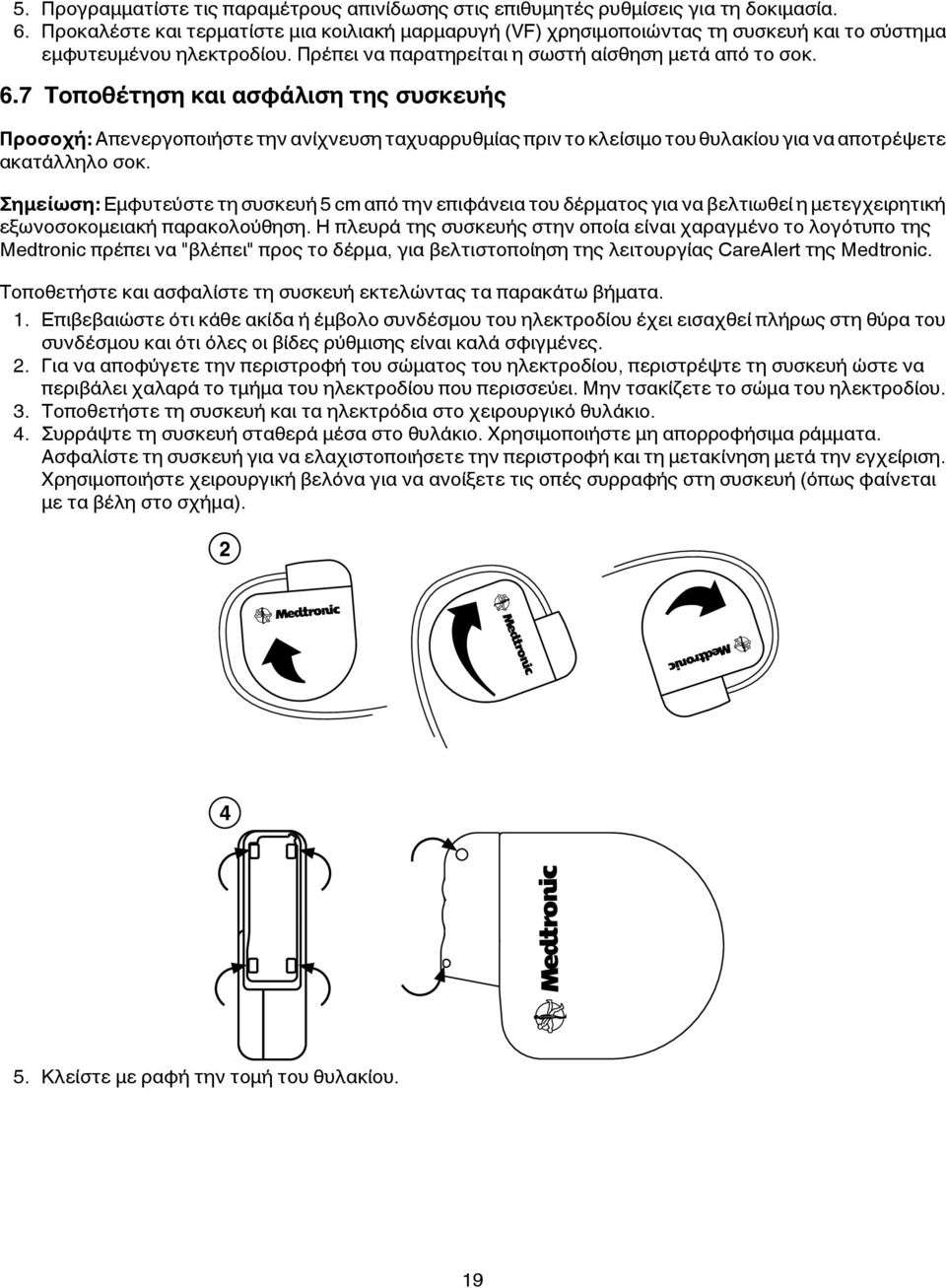 7 Τοποθέτηση και ασφάλιση της συσκευής Προσοχή: Απενεργοποιήστε την ανίχνευση ταχυαρρυθμίας πριν το κλείσιμο του θυλακίου για να αποτρέψετε ακατάλληλο σοκ.
