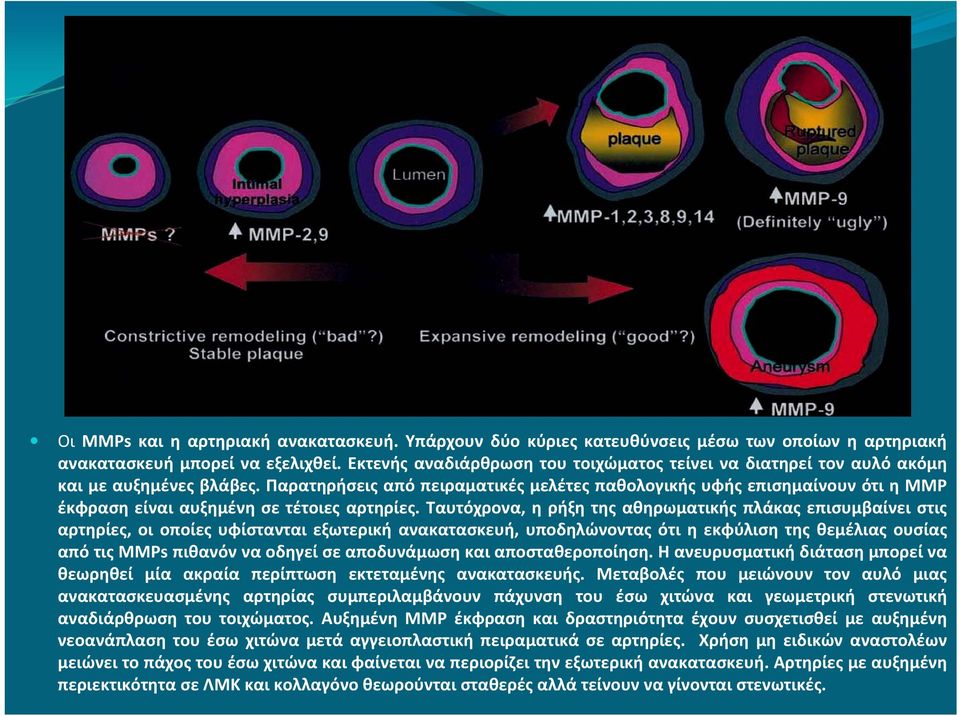Παρατηρήσεις από πειραματικές μελέτες παθολογικής υφής επισημαίνουν ότι η ΜΜΡ έκφραση είναι αυξημένη σε τέτοιες αρτηρίες.