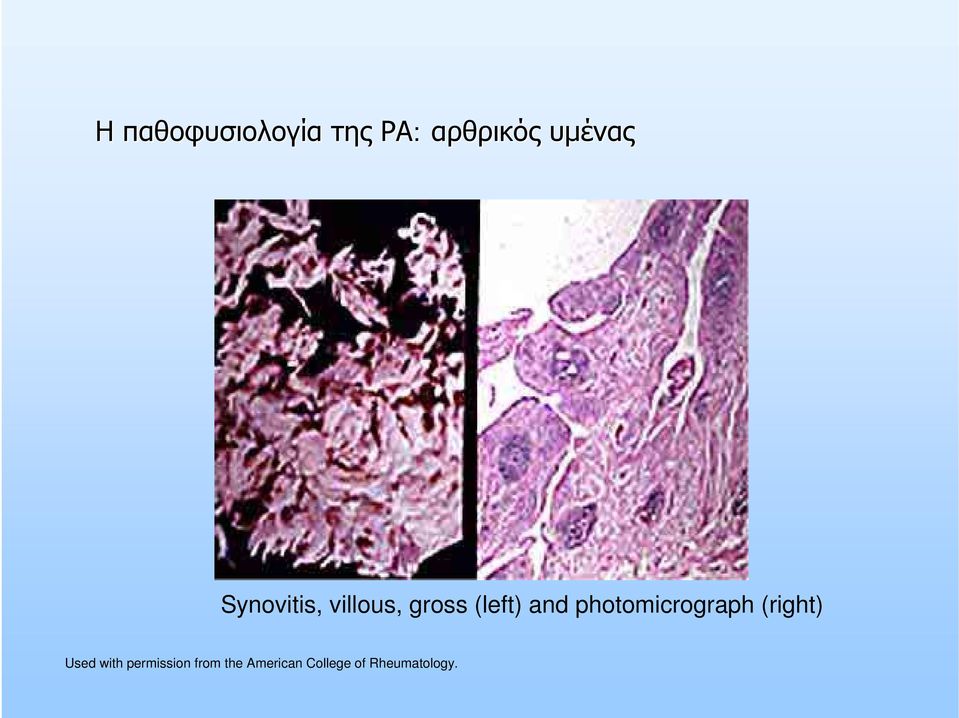 photomicrograph (right) Used with