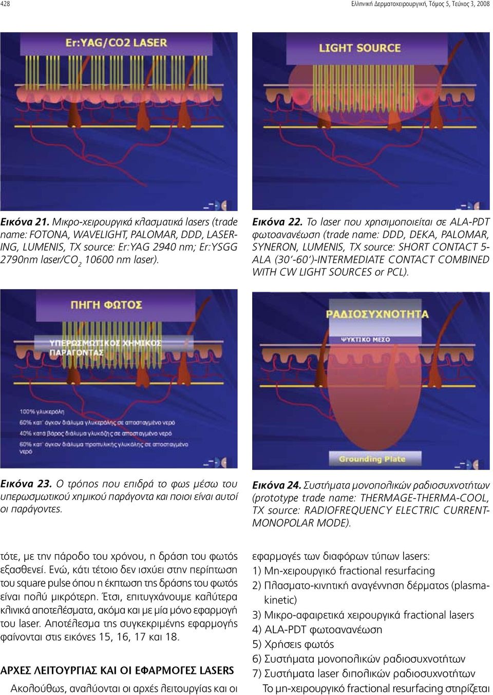 Το laser που χρησιμοποιείται σε ALA-PDT φωτοανανέωση (trade name: DDD, DEKA, PALOMAR, SYNERON, LUMENIS, TX source: SHORT CONTACT 5- ALA (30-60 )-INTERMEDIATE CONTACT COMBINED WITH CW LIGHT SOURCES or