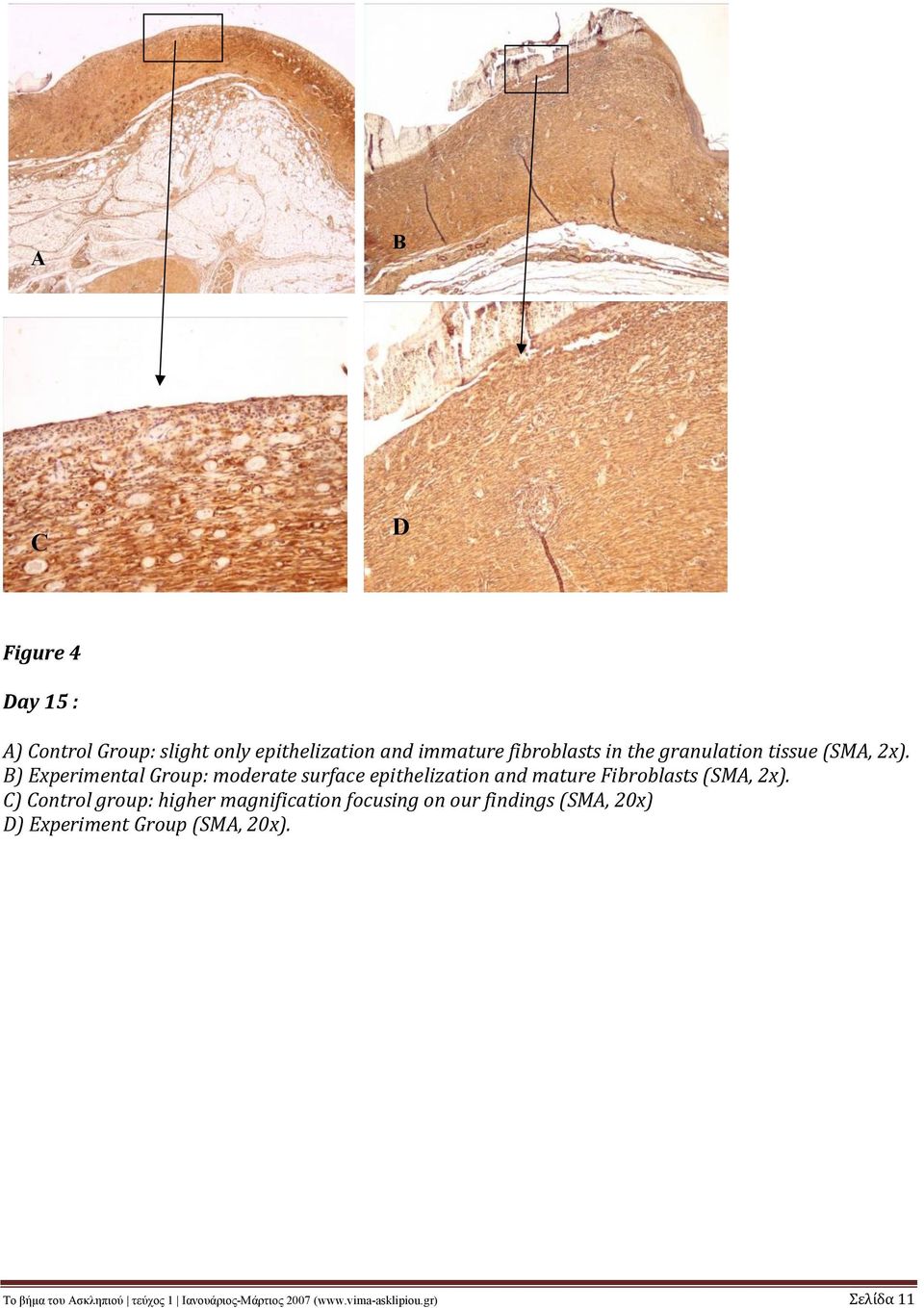 B) Experimental Group: moderate surface epithelization and mature Fibroblasts (SMA, 2x).