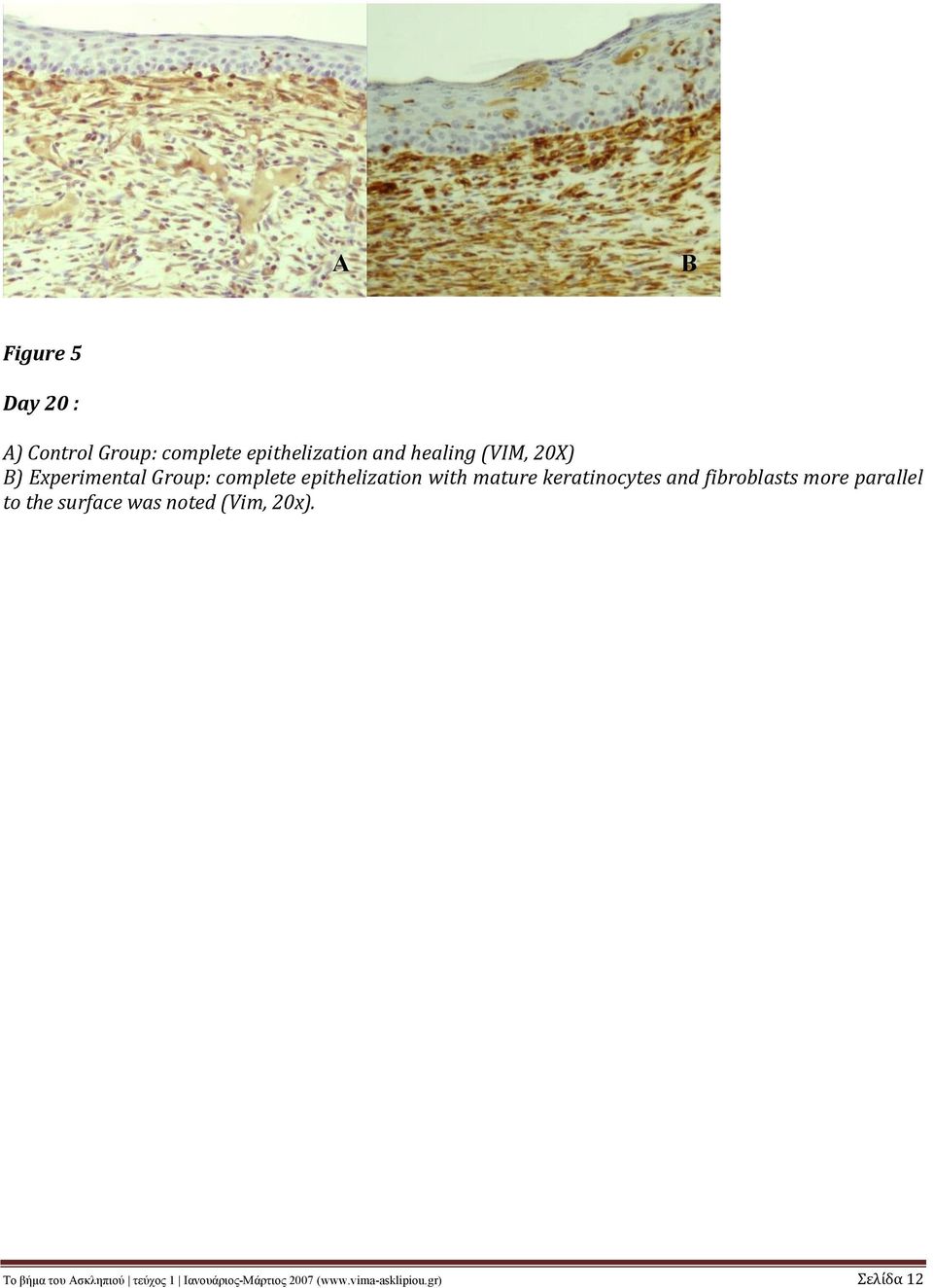 keratinocytes and fibroblasts more parallel to the surface was noted (Vim,