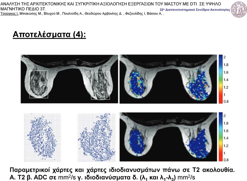 ακολουθία. Α. Τ2 β. ADC σε mm 2 /s γ.