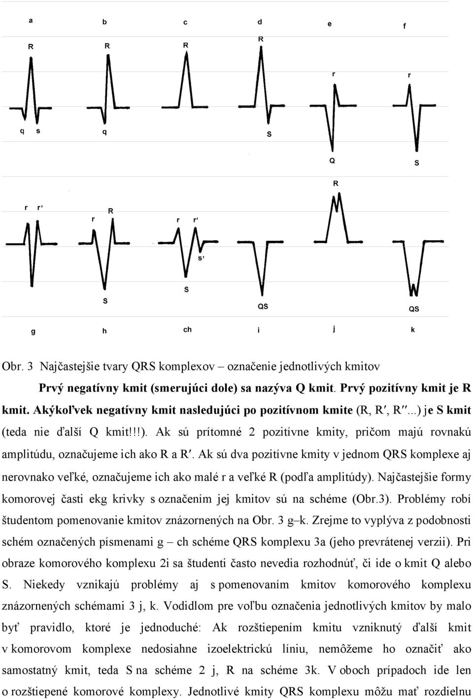 Ak sú dva pozitívne kmity v jednom QRS komplexe aj nerovnako veľké, označujeme ich ako malé r a veľké R (podľa amplitúdy).