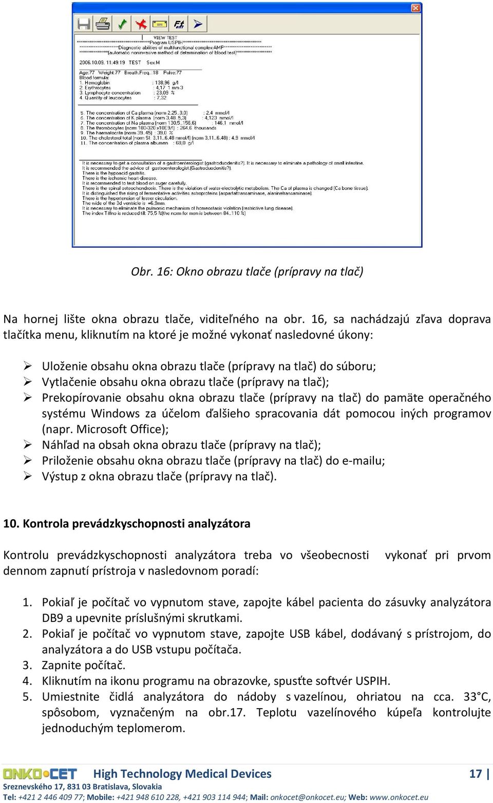 tlače (prípravy na tlač); Prekopírovanie obsahu okna obrazu tlače (prípravy na tlač) do pamäte operačného systému Windows za účelom ďalšieho spracovania dát pomocou iných programov (napr.