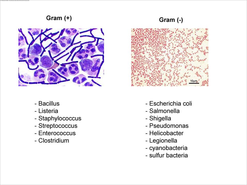 Clostridium - Escherichia coli - Salmonella - Shigella