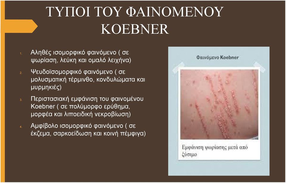 Ψευδοϊσομορφικό φαινόμενο ( σε μολυσματική τέρμινθο, κονδυλώματα και μυρμηκιές) 3.