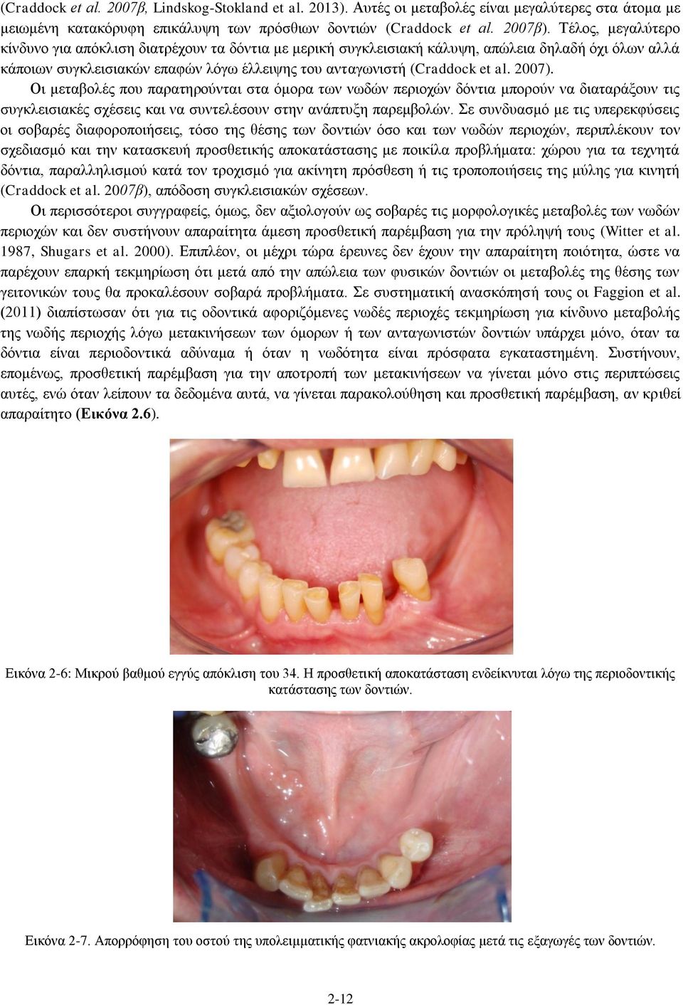 2007). Οι μεταβολές που παρατηρούνται στα όμορα των νωδών περιοχών δόντια μπορούν να διαταράξουν τις συγκλεισιακές σχέσεις και να συντελέσουν στην ανάπτυξη παρεμβολών.
