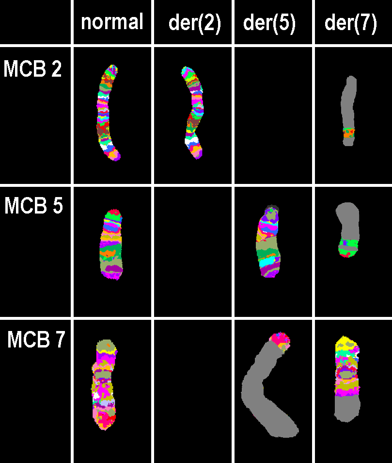 Αποτελέσματα- πολυχρωματικών ζωνών Μulticolor banding (MCB) and spectral karyotyping(wcp, BAC FISH ) Τ.