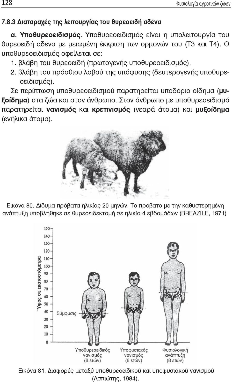 βλάβη του πρόσθιου λοβού της υπόφυσης (δευτερογενής υποθυρεοειδισμός). Σε περίπτωση υποθυρεοειδισμού παρατηρείται υποδόριο οίδημα (μυξοίδημα) στα ζώα και στον άνθρωπο.