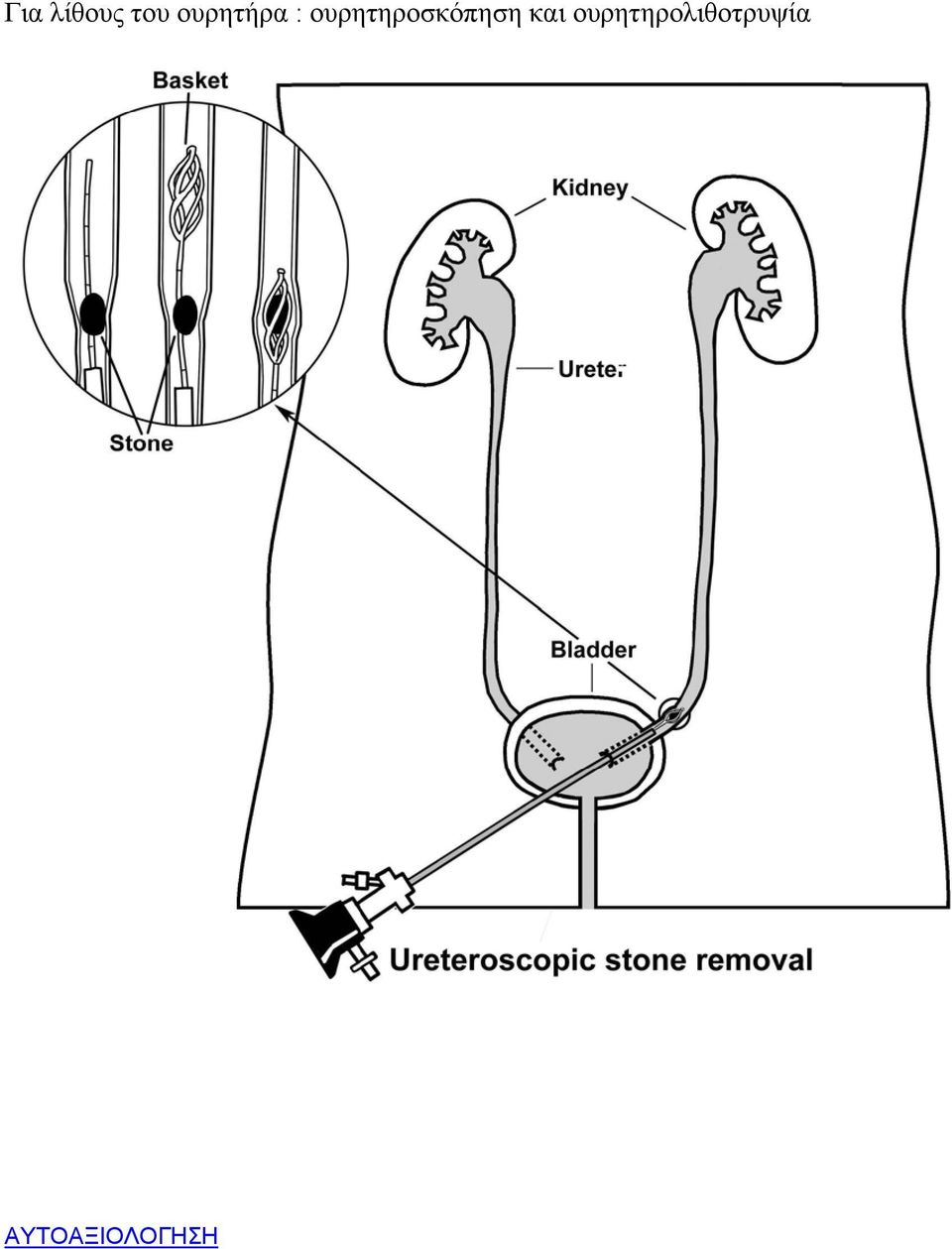 ουρητηροσκόπηση και