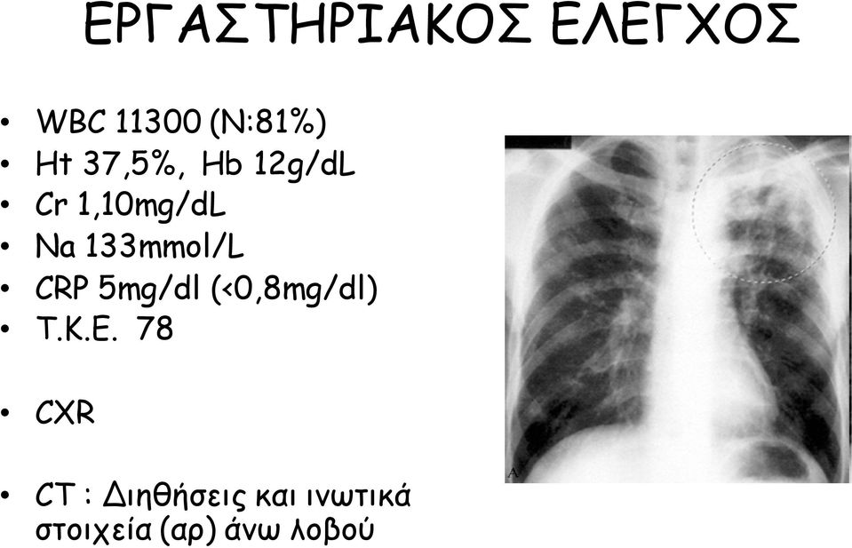 CRP 5mg/dl (<0,8mg/dl) Τ.Κ.Ε.