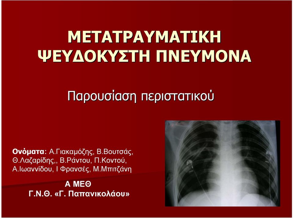 Βουτσάς, Θ.Λαζαρίδης,, Β.Ράντου, Π.Κοντού, Α.