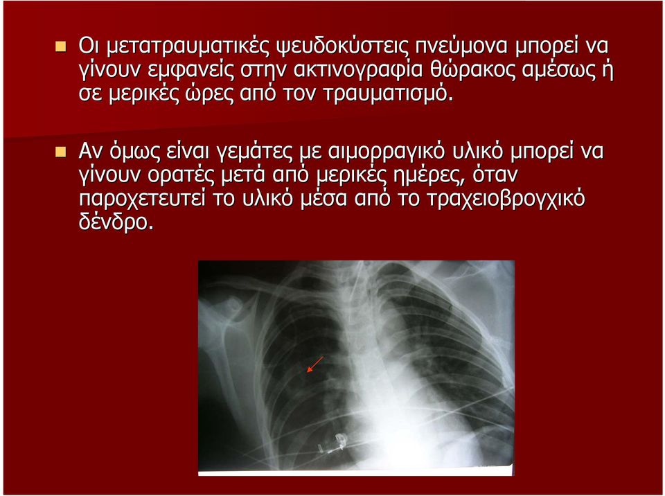 Αν όµως είναι γεµάτες µε αιµορραγικό υλικό µπορεί να γίνουν ορατές µετά